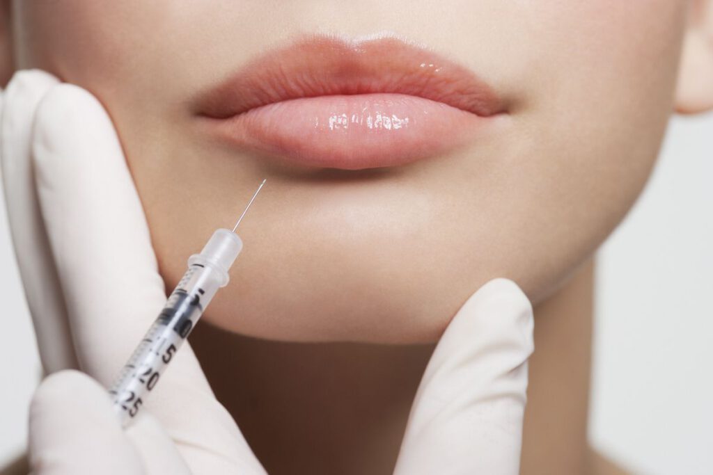 De geheimen van injectables voor lipvergroting: alles wat je moet weten!